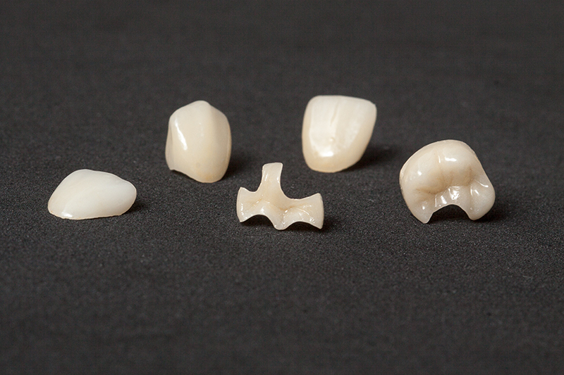 Crowns, inlays and veneers of leucite ceramics