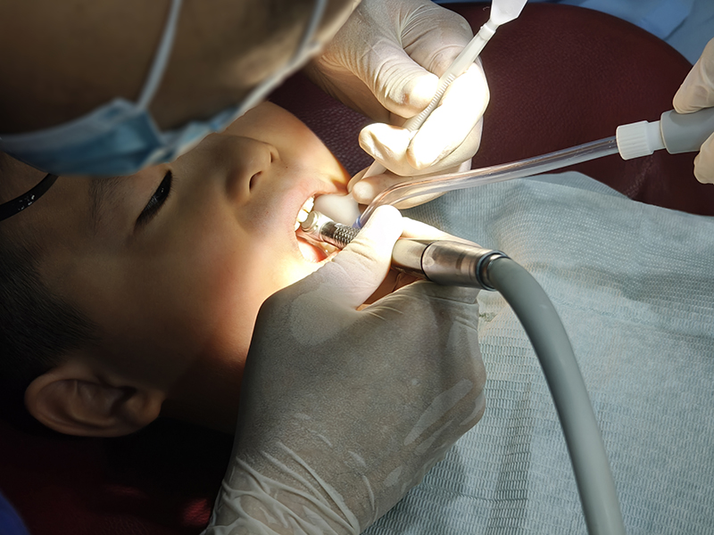 The little boy is having his cavity repaired at the dental hospital